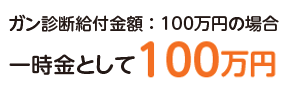 KfftzF100~̏ꍇ@ꎞƂ100~